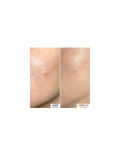 ERBORIAN CENTELLA SOS PATCH 9ML 2