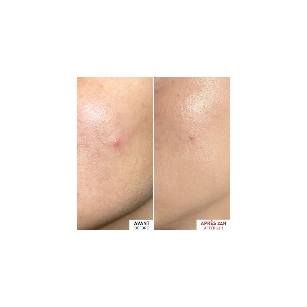 ERBORIAN CENTELLA SOS PATCH 9ML