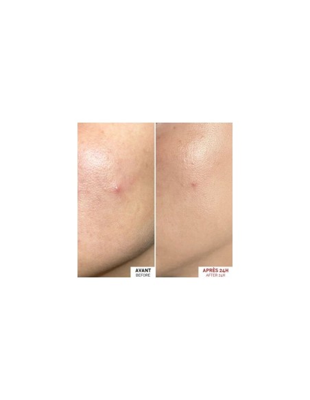 ERBORIAN CENTELLA SOS PATCH 9ML