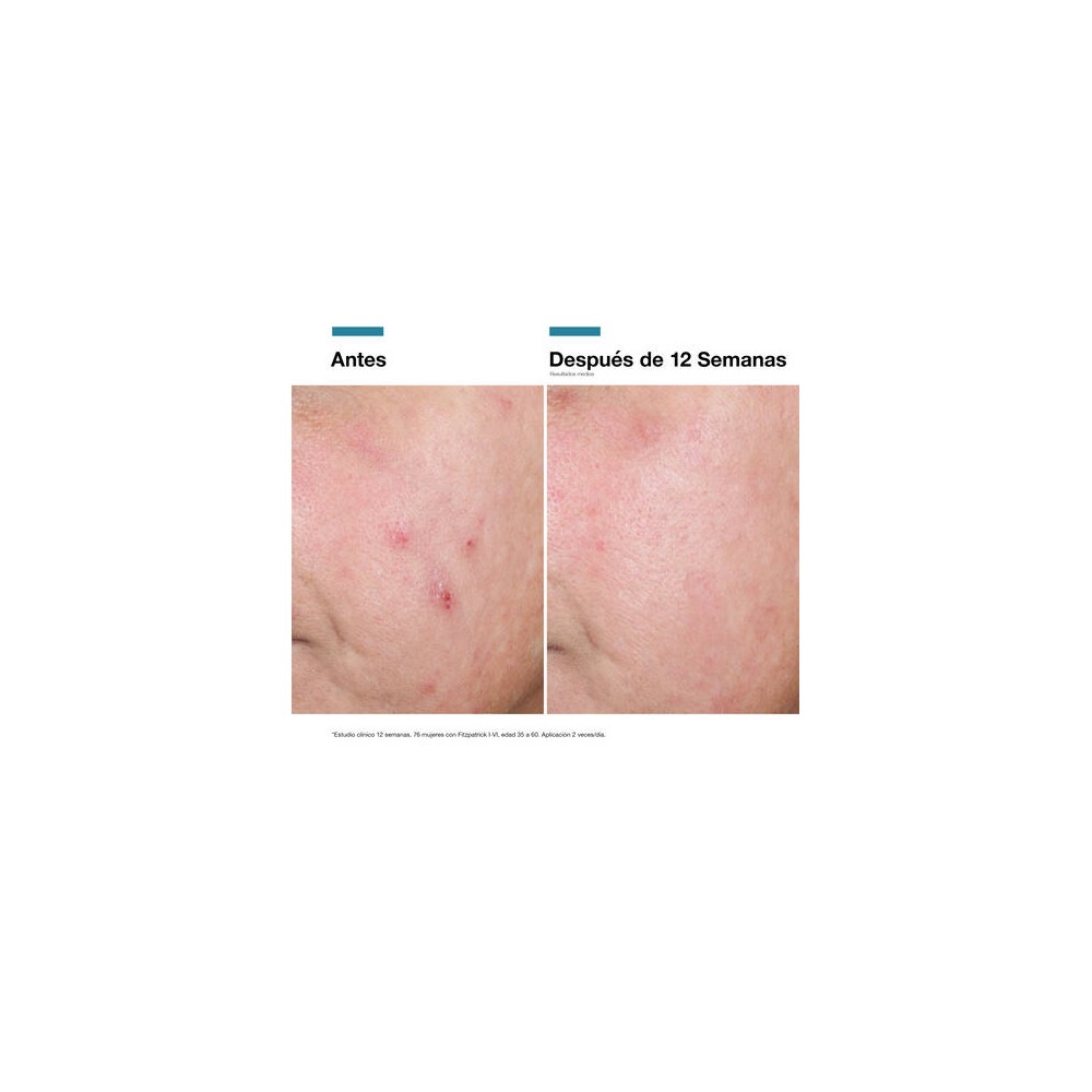 SKINCEUTICAL RGN-6 ADVANCED CREMA REPARADORA...