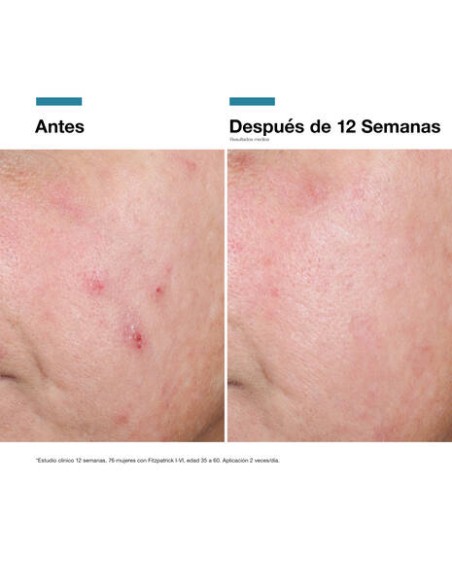 SKINCEUTICAL RGN-6 ADVANCED CREMA REPARADORA ANTIEDAD 50ML