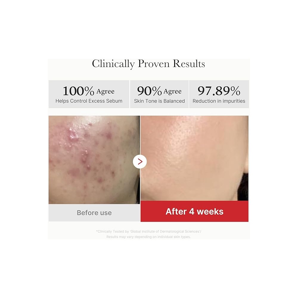 MEDICUBE PAD RED SUCCINIC ACID PEELING PARCHE...